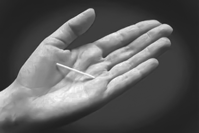 避妊インプラント（ネクスプラノン）とは？